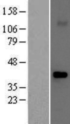 Western Blot: Fbx32 Overexpression Lysate (Adult Normal) [NBP2-05797] Left-Empty vector transfected control cell lysate (HEK293 cell lysate); Right -Over-expression Lysate for Fbx32.