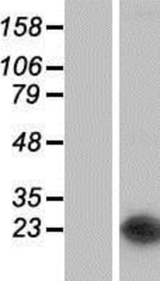 Western Blot: NUDT16 Overexpression Lysate (Adult Normal) [NBP2-05376] Left-Empty vector transfected control cell lysate (HEK293 cell lysate); Right -Over-expression Lysate for NUDT16.