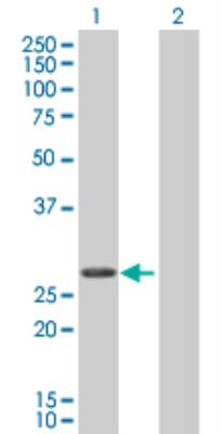 Western Blot: Troponin I Type 3 (cardiac) Overexpression Lysate (Denatured) [H00007137-T01] - Lane 1: TNNI3 transfected lysate (24 KDa). Lane 2: Non-transfected lysate.