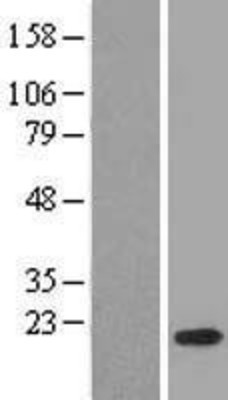 Western Blot: MPV17L2 Overexpression Lysate (Adult Normal) [NBL1-10744] Left-Empty vector transfected control cell lysate (HEK293 cell lysate); Right -Over-expression Lysate for MPV17L2.