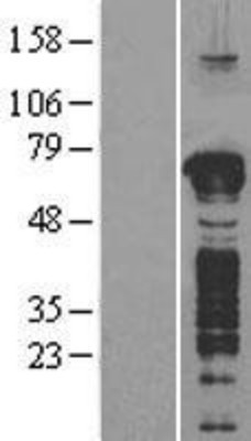 Western Blot: GFOD1 Overexpression Lysate (Adult Normal) [NBP2-04374] Left-Empty vector transfected control cell lysate (HEK293 cell lysate); Right -Over-expression Lysate for GFOD1.