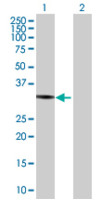 Lane 1: SETD4 transfected lysate (33.88 KDa) Lane 2: Non-transfected lysate.
