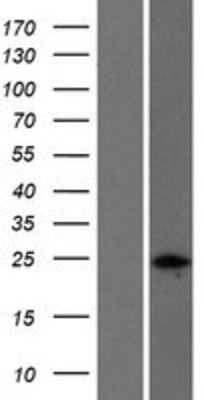 Western Blot: Nucleoplasmin-2 Overexpression Lysate (Adult Normal) [NBP2-04813] Left-Empty vector transfected control cell lysate (HEK293 cell lysate); Right -Over-expression Lysate for Nucleoplasmin-2.