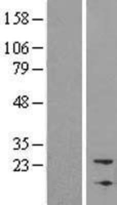 Western Blot: NBL1 Overexpression Lysate (Adult Normal) [NBL1-13496] Left-Empty vector transfected control cell lysate (HEK293 cell lysate); Right -Over-expression Lysate for NBL1.