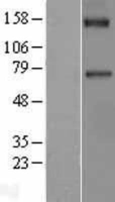 Western Blot: Factor XI Overexpression Lysate (Adult Normal) [NBL1-10403] Left-Empty vector transfected control cell lysate (HEK293 cell lysate); Right -Over-expression Lysate for Factor XI.