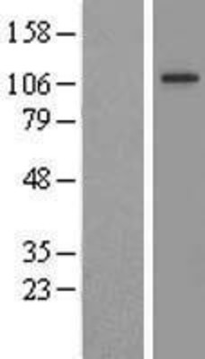 Western Blot: FIG4 Overexpression Lysate (Adult Normal) [NBL1-10721] Left-Empty vector transfected control cell lysate (HEK293 cell lysate); Right -Over-expression Lysate for FIG4.