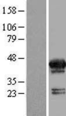 Western Blot: MVK Overexpression Lysate (Adult Normal) [NBP2-09397] Left-Empty vector transfected control cell lysate (HEK293 cell lysate); Right -Over-expression Lysate for MVK.