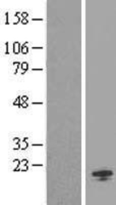 Western Blot: ORMDL1 Overexpression Lysate (Adult Normal) [NBP2-09468] Left-Empty vector transfected control cell lysate (HEK293 cell lysate); Right -Over-expression Lysate for ORMDL1.