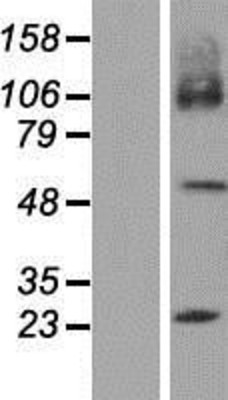 Western Blot: SLC7A7 Overexpression Lysate (Adult Normal) [NBP2-09420] Left-Empty vector transfected control cell lysate (HEK293 cell lysate); Right -Over-expression Lysate for SLC7A7.