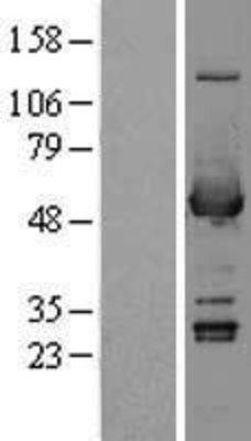 Western Blot: ALDH3A1 Overexpression Lysate (Adult Normal) [NBP2-09567] Left-Empty vector transfected control cell lysate (HEK293 cell lysate); Right -Over-expression Lysate for ALDH3A1.