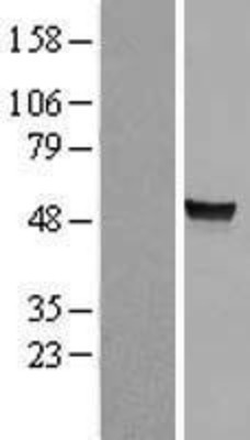 Western Blot: ARSA Overexpression Lysate (Adult Normal) [NBP2-09291] Left-Empty vector transfected control cell lysate (HEK293 cell lysate); Right -Over-expression Lysate for ARSA.