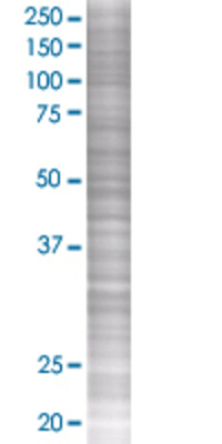 YY1 transfected lysate.
