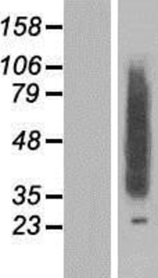 Western Blot: CLN8 Overexpression Lysate (Adult Normal) [NBP2-06756] Left-Empty vector transfected control cell lysate (HEK293 cell lysate); Right -Over-expression Lysate for CLN8.