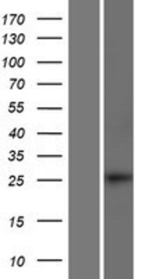 Western Blot: SMAD6 Overexpression Lysate (Adult Normal) [NBP2-09672] Left-Empty vector transfected control cell lysate (HEK293 cell lysate); Right -Over-expression Lysate for SMAD6.