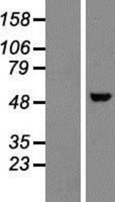 Western Blot: Nova1 Overexpression Lysate (Adult Normal) [NBP2-09833] Left-Empty vector transfected control cell lysate (HEK293 cell lysate); Right -Over-expression Lysate for Nova1.