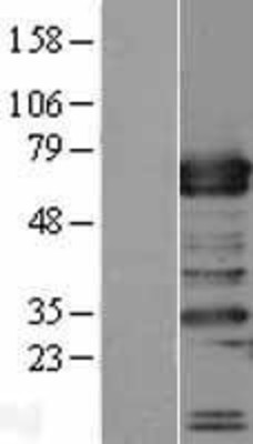 Western Blot: TRAFD1 Overexpression Lysate (Adult Normal) [NBP2-09698] Left-Empty vector transfected control cell lysate (HEK293 cell lysate); Right -Over-expression Lysate for TRAFD1.