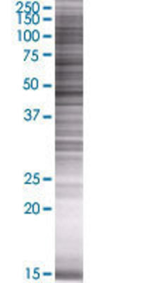CTBS transfected lysate.
