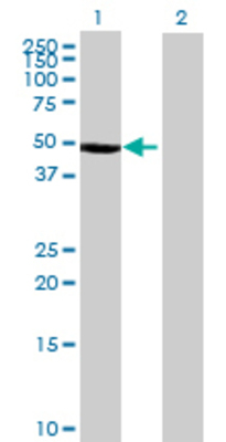 Lane 1: CTBS transfected lysate (42.46 KDa) Lane 2: Non-transfected lysate.