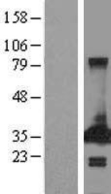 Western Blot: PECR Overexpression Lysate (Adult Normal) [NBL1-14277] Left-Empty vector transfected control cell lysate (HEK293 cell lysate); Right -Over-expression Lysate for PECR.