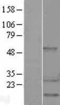 Western Blot: Hsp27 Overexpression Lysate (Adult Normal) [NBL1-11757] Left-Empty vector transfected control cell lysate (HEK293 cell lysate); Right -Over-expression Lysate for Hsp27.