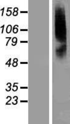 Western Blot: SLC22A8 Overexpression Lysate (Adult Normal) [NBL1-16042] Left-Empty vector transfected control cell lysate (HEK293 cell lysate); Right -Over-expression Lysate for SLC22A8.