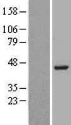 Western Blot: Beta Hydroxysteroid Dehydrogenase Overexpression Lysate (Adult Normal) [NBL1-11733] Left-Empty vector transfected control cell lysate (HEK293 cell lysate); Right -Over-expression Lysate for Beta Hydroxysteroid Dehydrogenase.