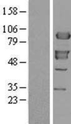 Western Blot: XRCC1 Overexpression Lysate (Adult Normal) [NBL1-17913] Left-Empty vector transfected control cell lysate (HEK293 cell lysate); Right -Over-expression Lysate for XRCC1.