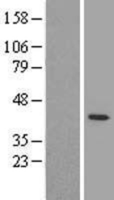 Western Blot: SELS Overexpression Lysate (Adult Normal) [NBL1-15796] Left-Empty vector transfected control cell lysate (HEK293 cell lysate); Right -Over-expression Lysate for SELS.