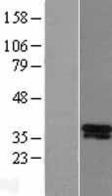 Western Blot: Dlx5 Overexpression Lysate (Adult Normal) [NBL1-09921] Left-Empty vector transfected control cell lysate (HEK293 cell lysate); Right -Over-expression Lysate for Dlx5.