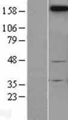 Western Blot: Neogenin Overexpression Lysate (Adult Normal) [NBL1-13591] Left-Empty vector transfected control cell lysate (HEK293 cell lysate); Right -Over-expression Lysate for Neogenin.
