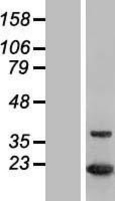 Western Blot: MTH1 Overexpression Lysate (Adult Normal) [NBL1-13852] Left-Empty vector transfected control cell lysate (HEK293 cell lysate); Right -Over-expression Lysate for MTH1.