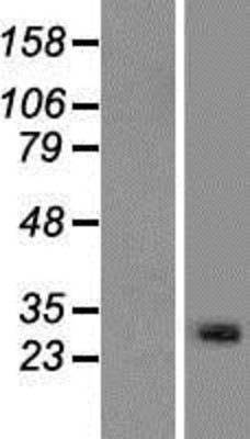 Western Blot: METTL21C Overexpression Lysate (Adult Normal) [NBP2-08774] Left-Empty vector transfected control cell lysate (HEK293 cell lysate); Right -Over-expression Lysate for METTL21C.