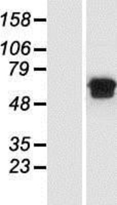Western Blot: MGAT2 Overexpression Lysate (Adult Normal) [NBP2-08752] Left-Empty vector transfected control cell lysate (HEK293 cell lysate); Right -Over-expression Lysate for MGAT2.
