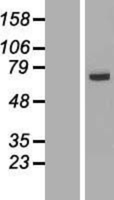 Western Blot: FAM116A Overexpression Lysate (Adult Normal) [NBL1-10451] Left-Empty vector transfected control cell lysate (HEK293 cell lysate); Right -Over-expression Lysate for FAM116A.