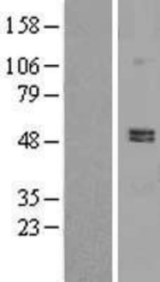 Western Blot: PDE7A Overexpression Lysate (Adult Normal) [NBL1-14230] Left-Empty vector transfected control cell lysate (HEK293 cell lysate); Right -Over-expression Lysate for PDE7A.