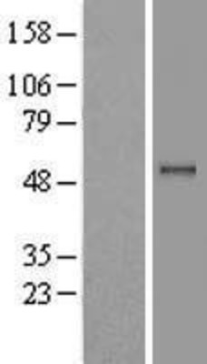Western Blot: PPM1B Overexpression Lysate (Adult Normal) [NBL1-14659] Left-Empty vector transfected control cell lysate (HEK293 cell lysate); Right -Over-expression Lysate for PPM1B.