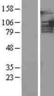 Western Blot: PTIP Overexpression Lysate (Adult Normal) [NBL1-14134] Left-Empty vector transfected control cell lysate (HEK293 cell lysate); Right -Over-expression Lysate for PTIP.