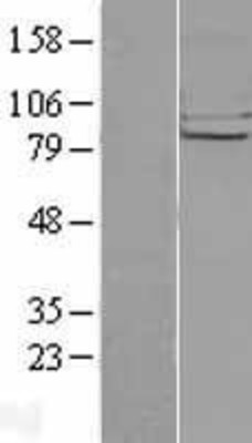 Western Blot: CHSS2 Overexpression Lysate (Adult Normal) [NBL1-09169] Left-Empty vector transfected control cell lysate (HEK293 cell lysate); Right -Over-expression Lysate for CHSS2.