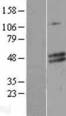 Western Blot: CECR5 Overexpression Lysate (Adult Normal) [NBL1-09079] Left-Empty vector transfected control cell lysate (HEK293 cell lysate); Right -Over-expression Lysate for CECR5.