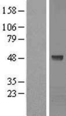 Western Blot: Kaptin Overexpression Lysate (Adult Normal) [NBL1-12375] Left-Empty vector transfected control cell lysate (HEK293 cell lysate); Right -Over-expression Lysate for Kaptin.