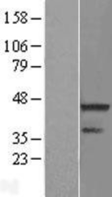 Western Blot: RNF113A Overexpression Lysate (Adult Normal) [NBL1-15411] Left-Empty vector transfected control cell lysate (HEK293 cell lysate); Right -Over-expression Lysate for RNF113A.