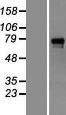 Western Blot: GAB1 Overexpression Lysate (Adult Normal) [NBL1-10904] Left-Empty vector transfected control cell lysate (HEK293 cell lysate); Right -Over-expression Lysate for GAB1.