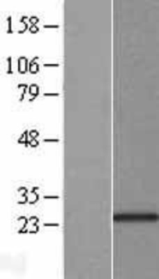 Western Blot: KChIP1 Overexpression Lysate (Adult Normal) [NBL1-12158] Left-Empty vector transfected control cell lysate (HEK293 cell lysate); Right -Over-expression Lysate for KChIP1.