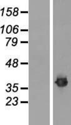 Western Blot: Fibrillarin Overexpression Lysate (Adult Normal) [NBL1-10607] Left-Empty vector transfected control cell lysate (HEK293 cell lysate); Right -Over-expression Lysate for Fibrillarin.