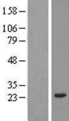 Western Blot: TIPRL Overexpression Lysate (Adult Normal) [NBL1-16935] Left-Empty vector transfected control cell lysate (HEK293 cell lysate); Right -Over-expression Lysate for TIPRL.