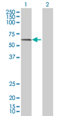 Lane 1: DARS transfected lysate (57.1 KDa) Lane 2: Non-transfected lysate.