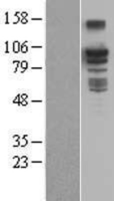 Western Blot: BCAR3 Overexpression Lysate (Adult Normal) [NBL1-07936] Left-Empty vector transfected control cell lysate (HEK293 cell lysate); Right -Over-expression Lysate for BCAR3.
