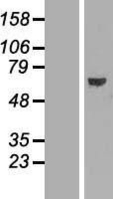Western Blot: ABCE1 Overexpression Lysate (Adult Normal) [NBL1-07183] Left-Empty vector transfected control cell lysate (HEK293 cell lysate); Right -Over-expression Lysate for ABCE1.