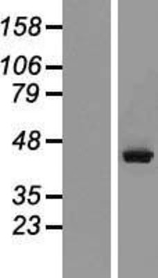 Western Blot: RRM2 Overexpression Lysate (Adult Normal) [NBP2-08553] Left-Empty vector transfected control cell lysate (HEK293 cell lysate); Right -Over-expression Lysate for RRM2.