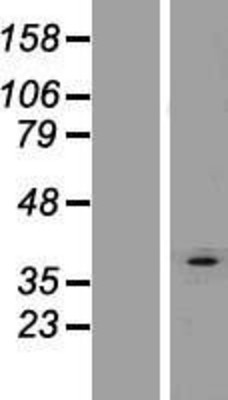 Western Blot: AGPAT3 Overexpression Lysate (Adult Normal) [NBP2-08549] Left-Empty vector transfected control cell lysate (HEK293 cell lysate); Right -Over-expression Lysate for AGPAT3.